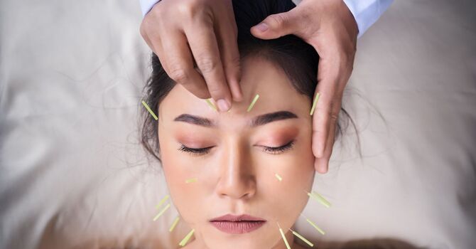 Research Roundup: Acupuncture and Immunity