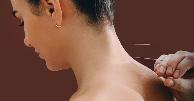 Research Roundup: Acupuncture and Immunity image